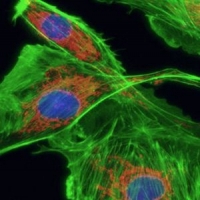 PCR熒光濾光片怎么選型？